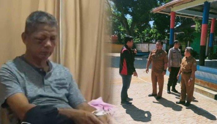 Baca kisah tragis seorang guru di Bengkulu yang diketapel oleh wali murid, mengalami kehilangan penglihatan mata kanan secara permanen